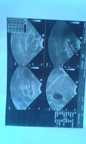 20150403_180626.jpg